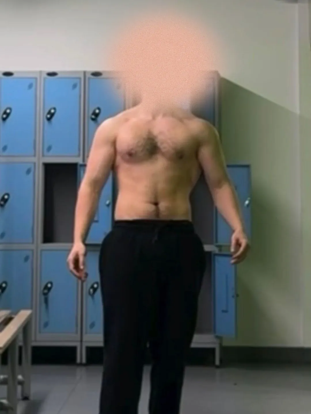 A client photographed before starting the programme